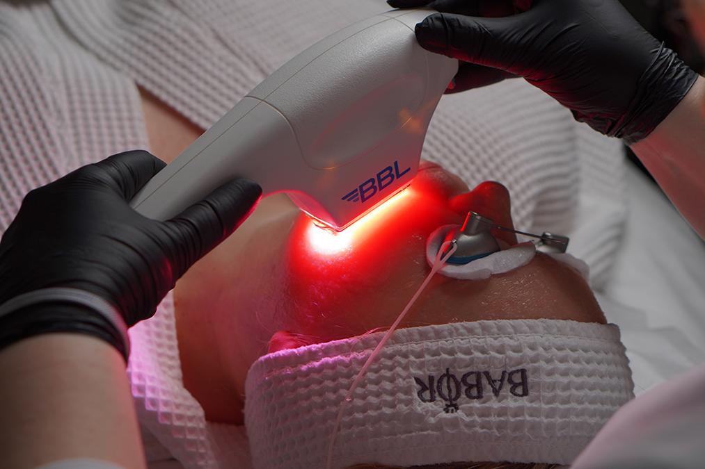 Инфракрасный термолифтинг SkinTyte II (СкинТайт)