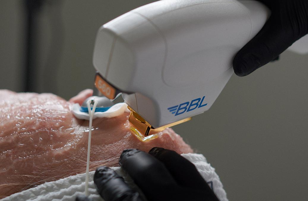 Холодный SKINTYTE BBL