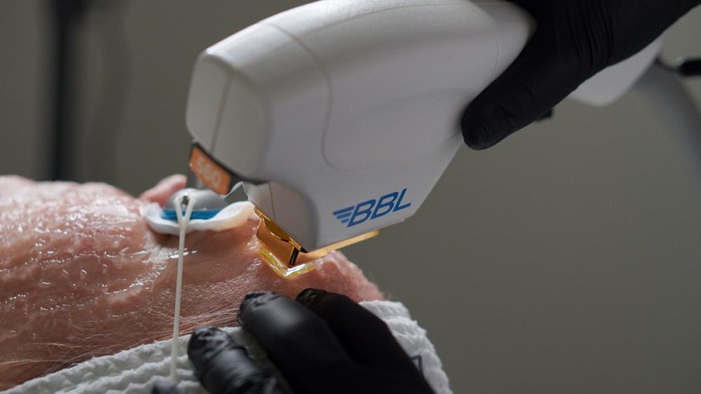 Холодный SKINTYTE BBL